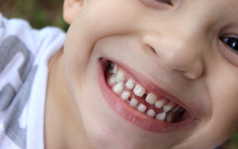 5 consigli per mantenere i denti dei bambini in salute